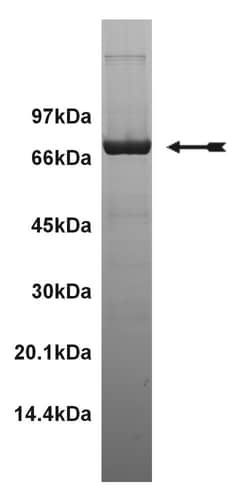 Eurofins DiscoverX CSK Protein, Active 250 &mu;g | Buy Online | Eurofins DiscoverX | Fisher Scientific